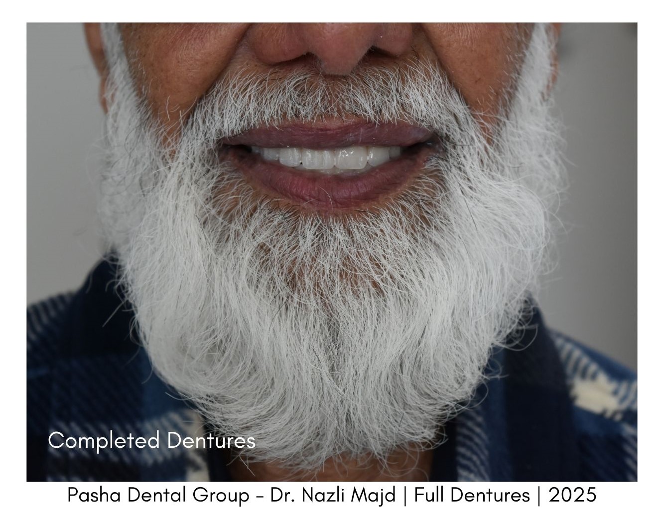 Dentures Mar Vista Los Angeles